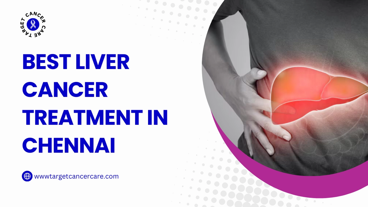 Best Liver Cancer Treatment in Chennai - Target Cancer Care