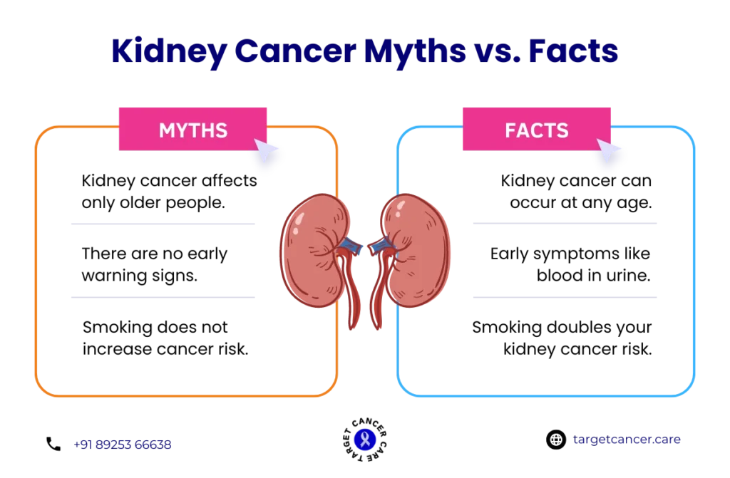 Kidney Cancer Myths vs. Facts