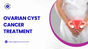 Ovarian Cyst Cancer Treatment