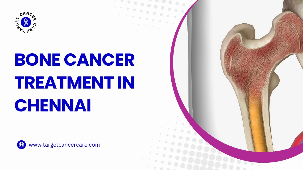 Bone Cancer Treatment in Chennai