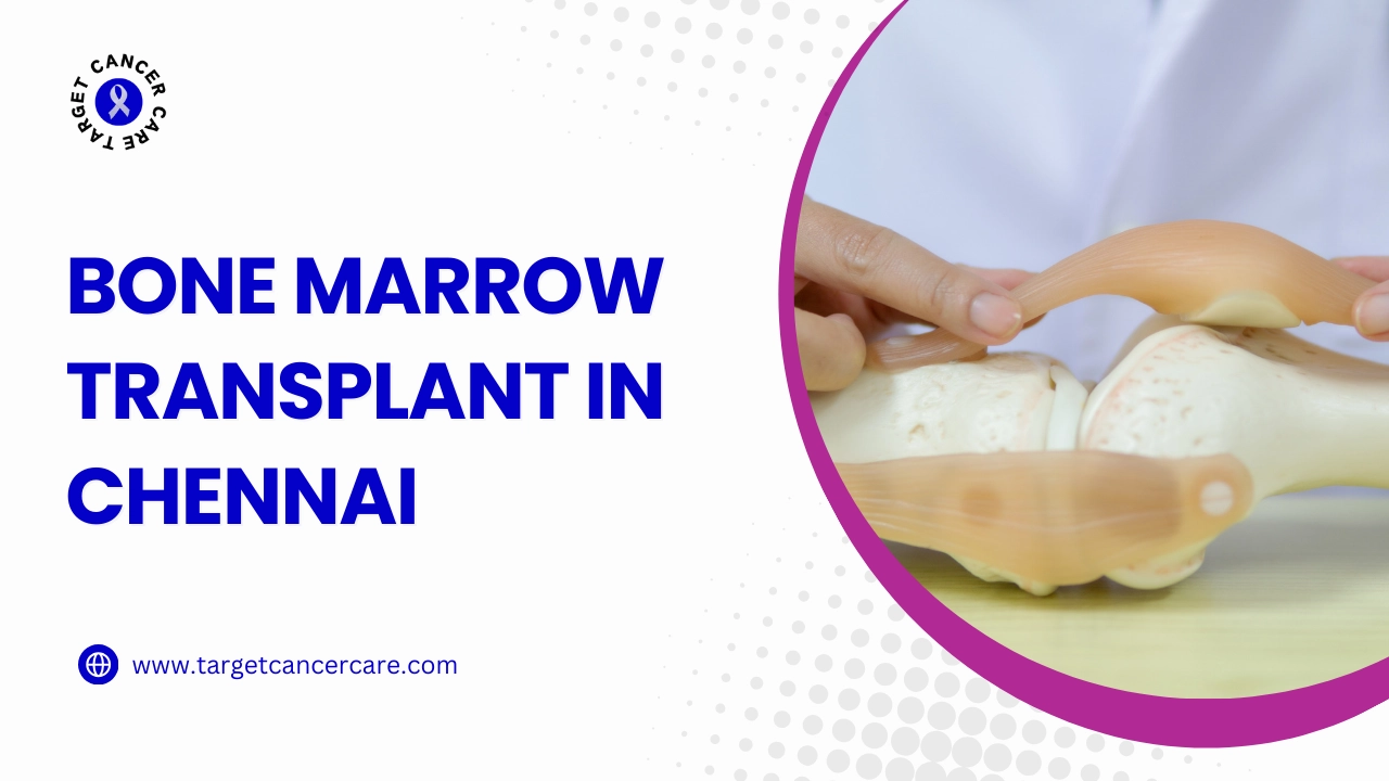 Bone Marrow Transplant in Chennai