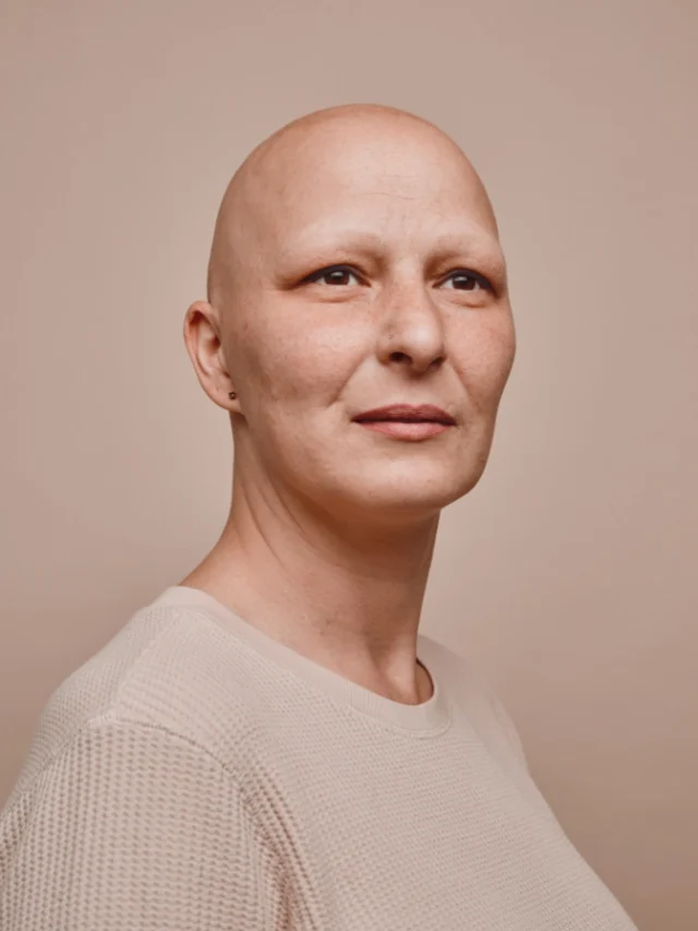 Head And Neck Cancer Treatment