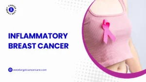 Inflammatory Breast Cancer