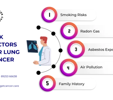Risk Factors for Lung Cancer 360x320