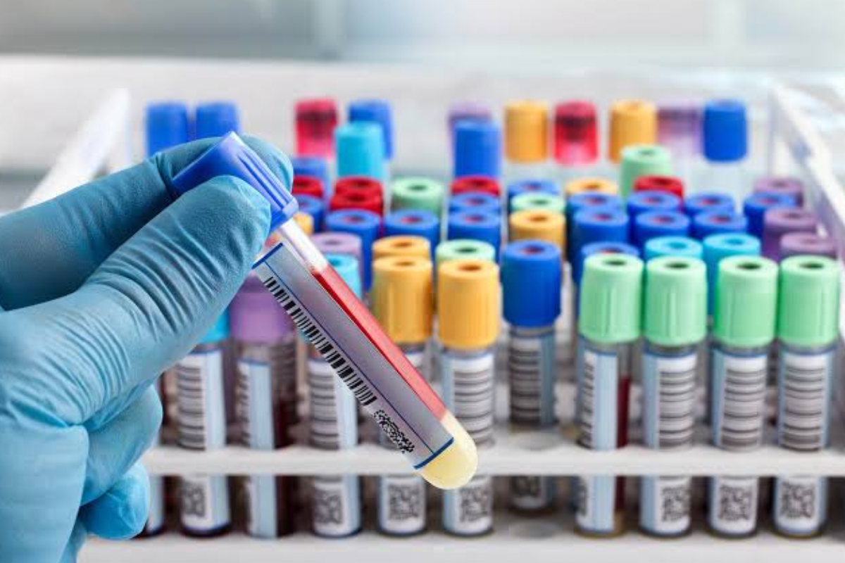 Cancer biomarker blood testing procedure