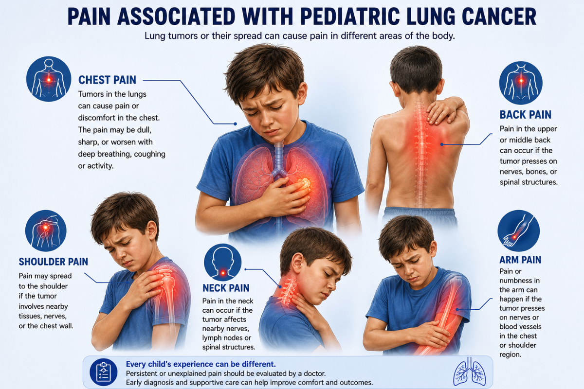 Illustration showing chest, back, shoulder, neck and arm pain associated with pediatric lung cancer