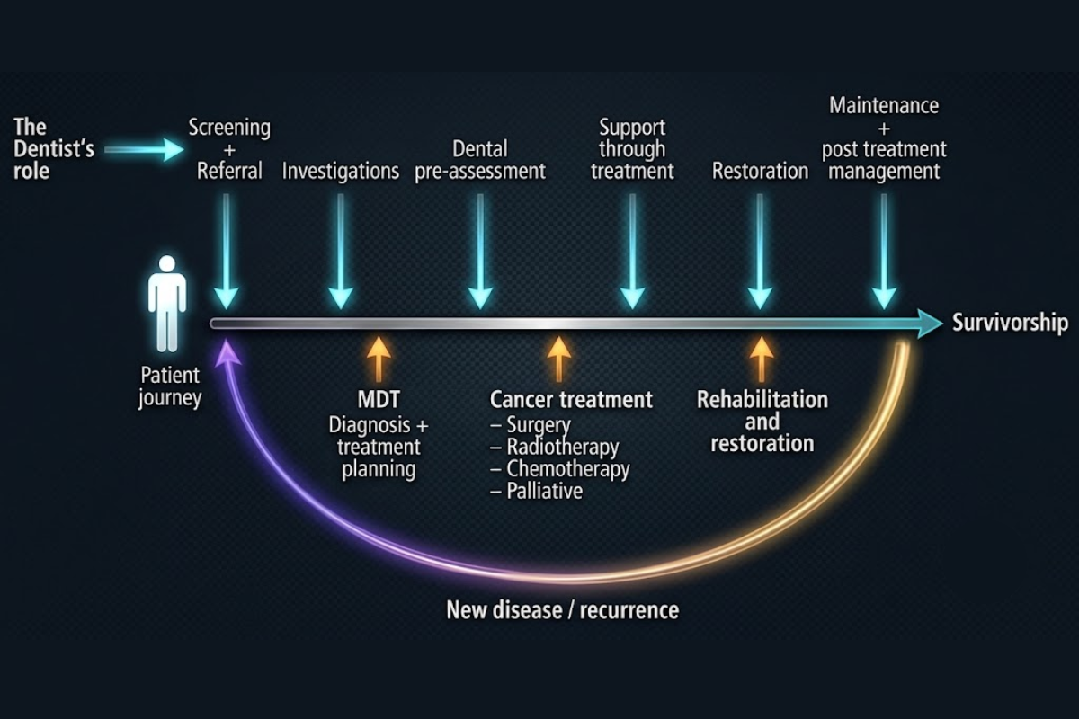 Oral cancer diagnosis and treatment process