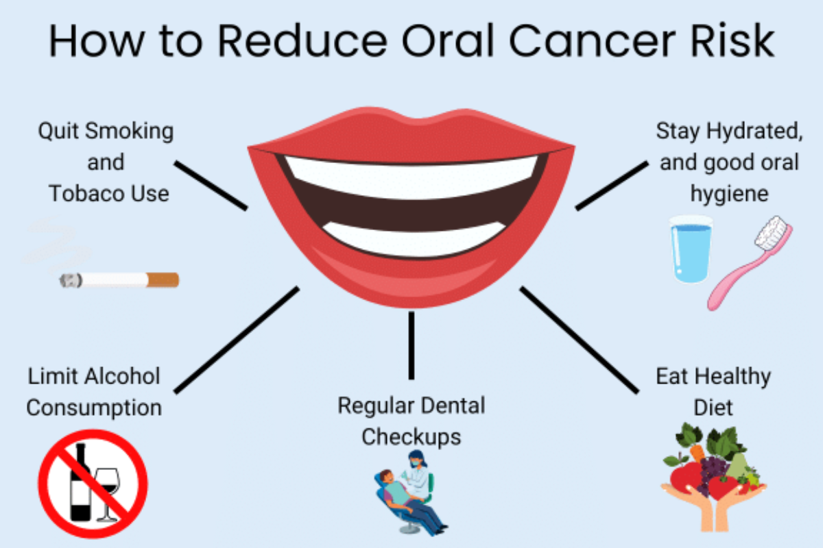 Healthy lifestyle habits to prevent oral cancer
