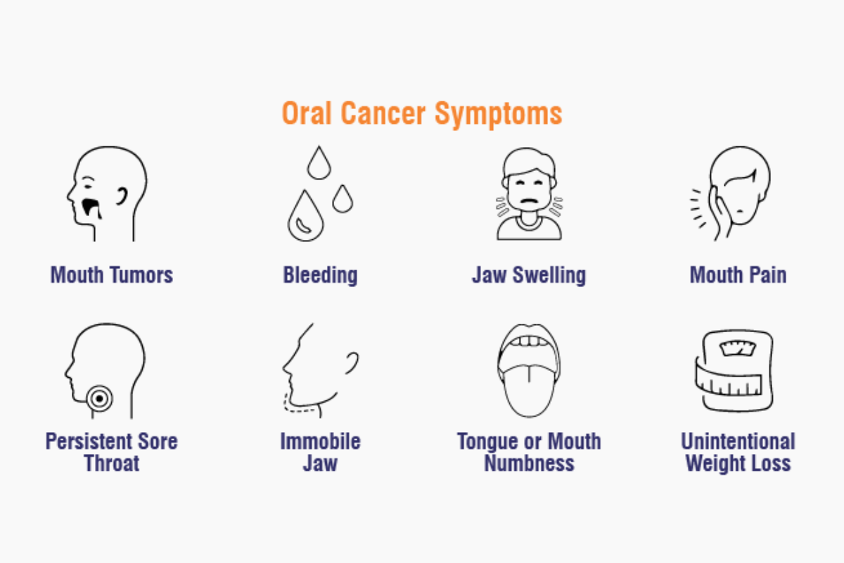 Visible oral cancer tumor symptoms in advanced stage