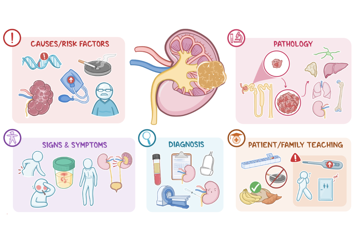Kidney cancer awareness and early diagnosis consultation
