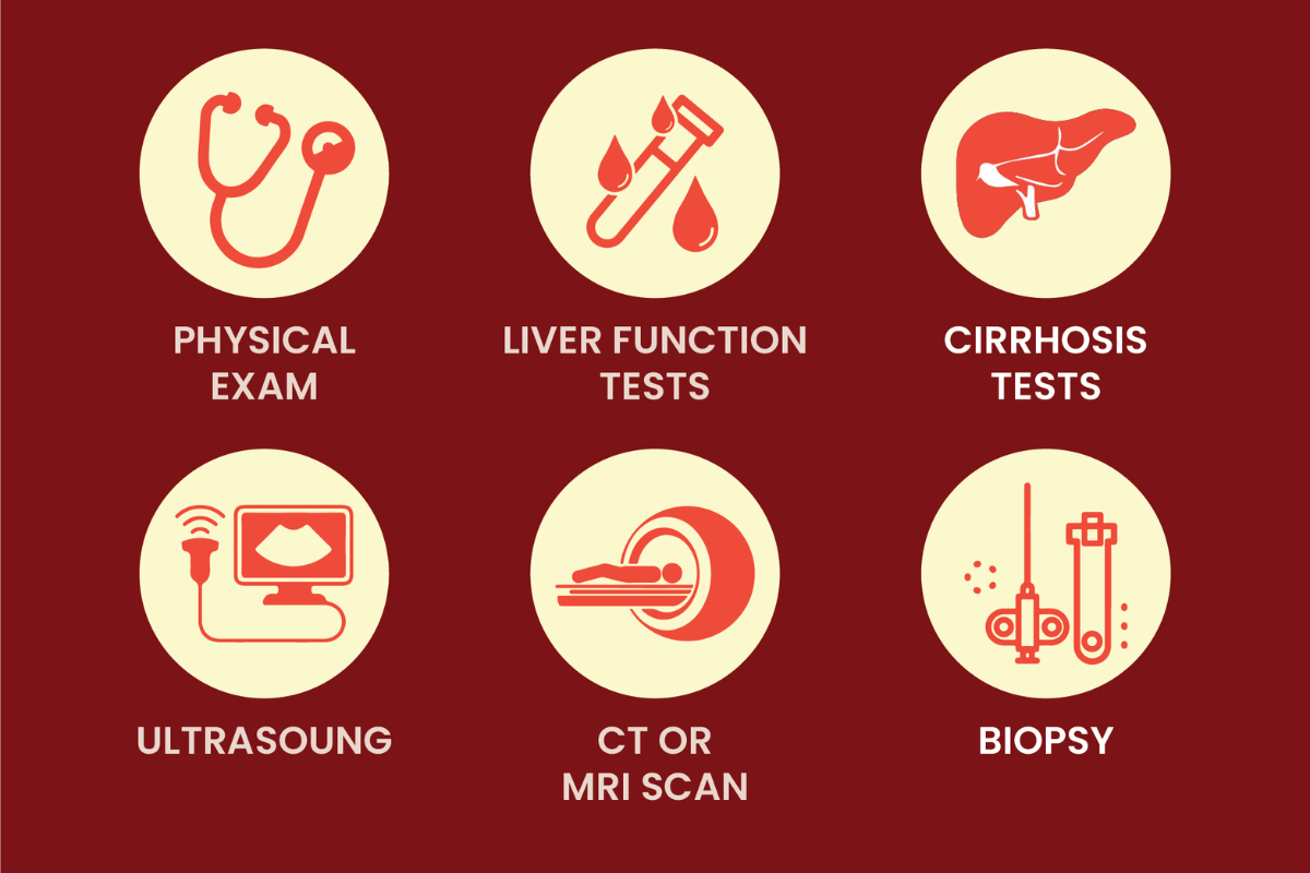 Diagnostic tests and imaging used for liver cancer detection